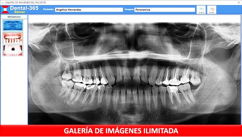 Galería de imágenes